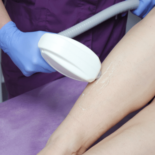 Laser Hair Removal In Edmonton Thoughtful Technologies