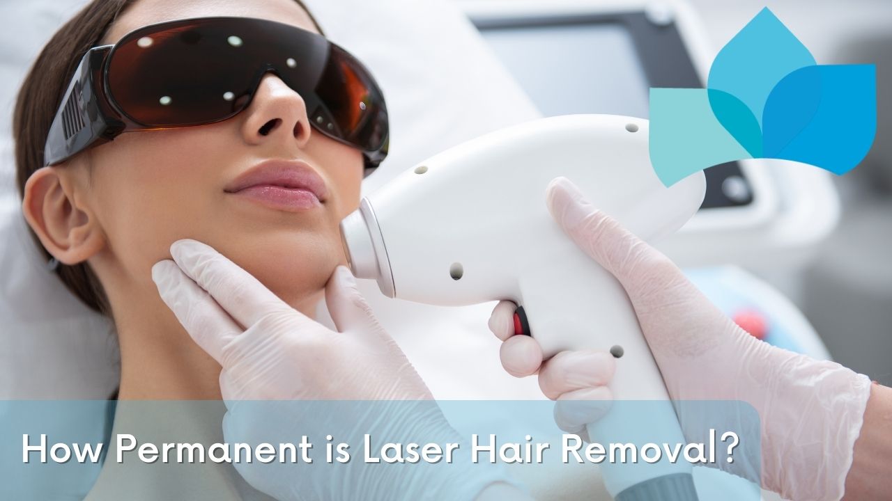 How Permanent is Laser Hair Removal