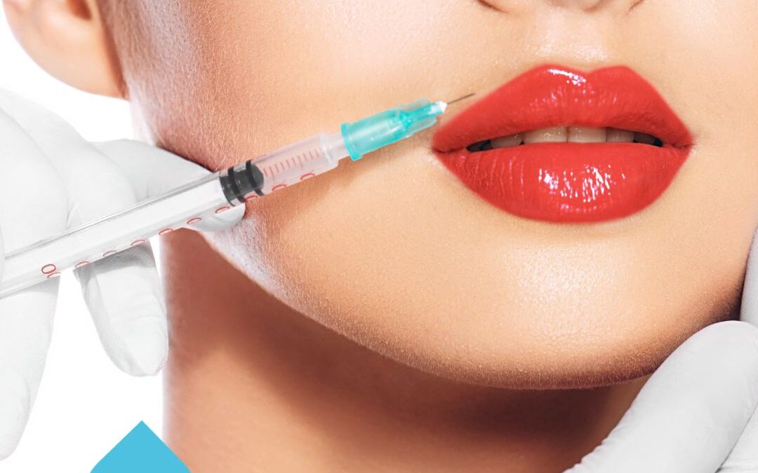 What You Need to Know About Lip Fillers