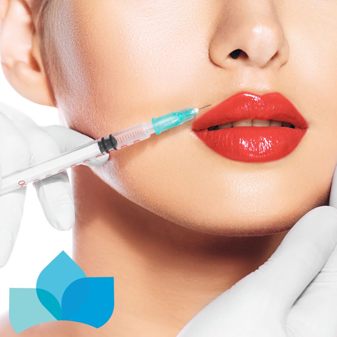 What You Need to Know About Lip Fillers Edmonton Dermatology