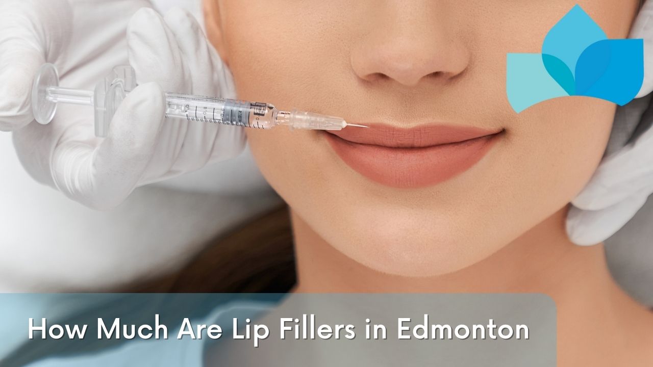 How Much Are Lip Fillers in Edmonton By Edmonton Dermatology