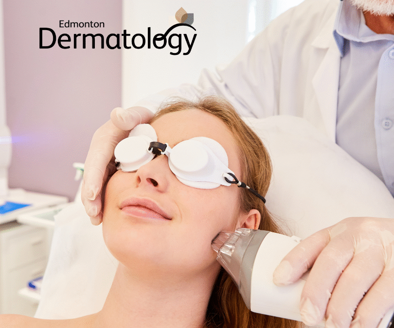 Why Women Are Giving Great Fraxel Laser Treatment Reviews in Edmonton!