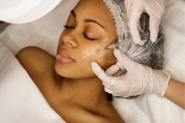 cosmetic fillers in Southgate by Edmonton Dermatology