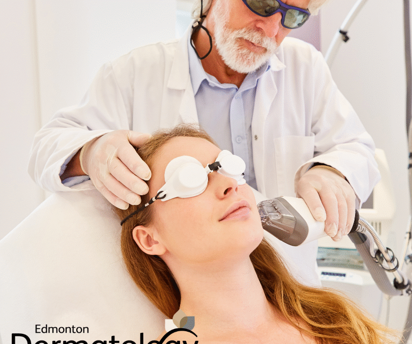 Say Goodbye to Facial Scarring with Fraxel Treatment for Acne Scars in Edmonton!