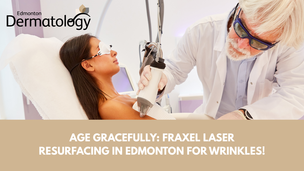 Fraxel laser resurfacing in Edmonton