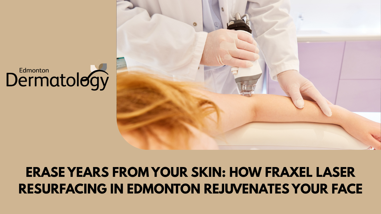 Fraxel Laser Resurfacing in Edmonton